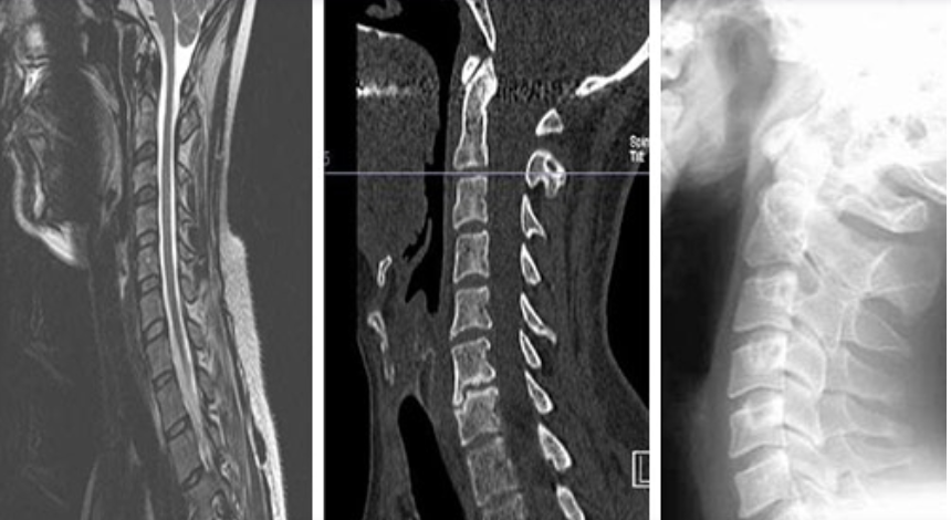 CT Scan Image